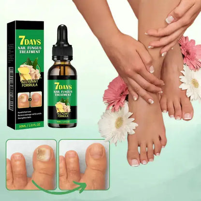 TRATAMENTO ANTI-FUNGOS 7 DIAS 100% NATURAL